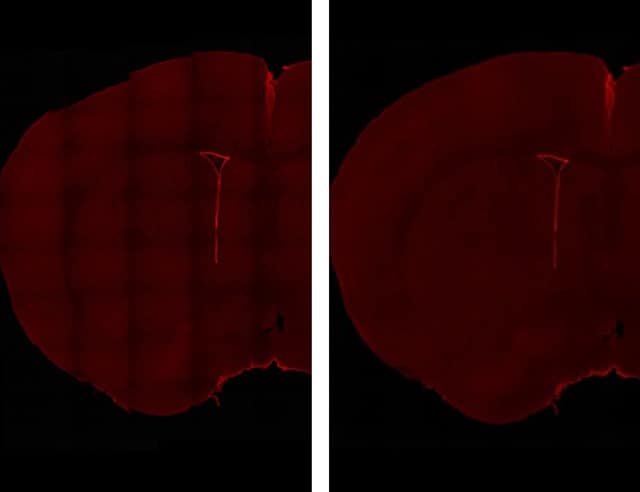 Bilder: Gefärbte Bilder von Ependymzellen einer erwachsenen Maus...