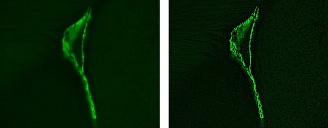 Bilder: Gefärbte vergrößerte Bilder von Ependymzellen einer erwachsenen Maus...