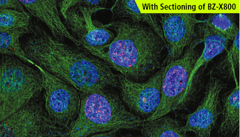 With Sectioning of BZ-X800