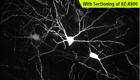 With Sectioning of BZ-X800