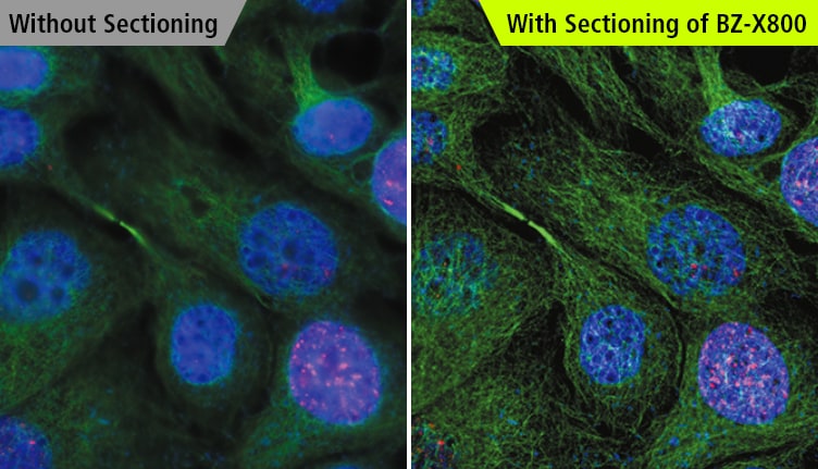 Without Sectioning / With Sectioning of BZ-X800