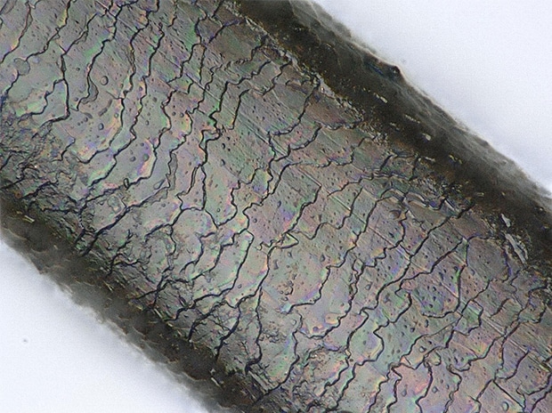 Nagelhaut, 2000x, Betrachtung mit Koaxialbeleuchtung