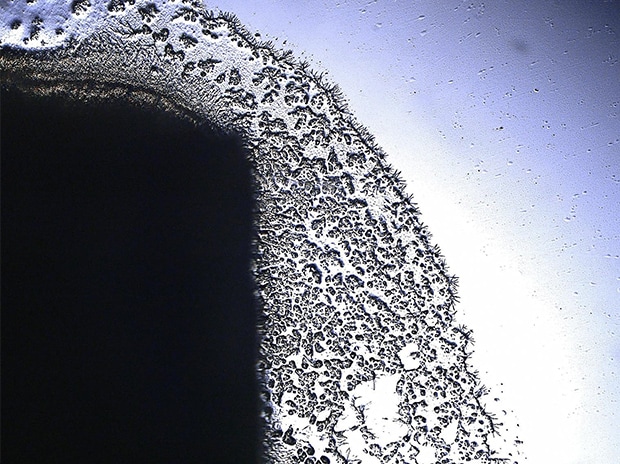 Bakterien, 200x, Betrachtung mit polarisierter Durchlichtbeleuchtung