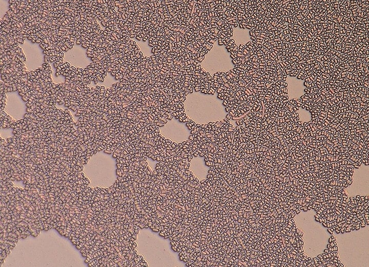 Koaxiale Teilbeleuchtung + HDR (2500x)