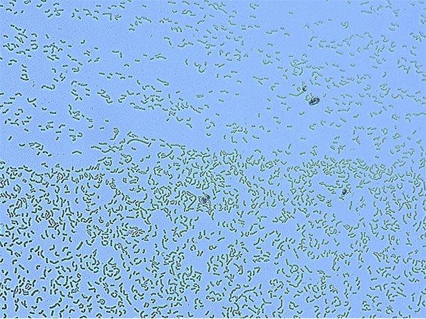 Betrachtungsbild mit Durchlichtbeleuchtung (1000x)