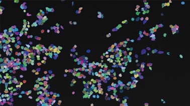 Zählung von Expressionsereignissen (fluoreszierende Punkte) anhand von Zellen im Auswahlbereich