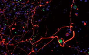 Differenzierung von ES-Zellen in Nervenzellen
