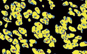 Zählung von Chromosomen in einem Zellkern