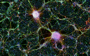 Aus menschlichen iPS-Zellen gewonnene Nervenzellen