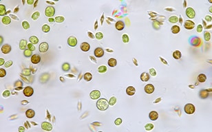 Die Modellreihe BZ-X beschleunigt die Algenöl-Forschung von Phycobloom und fördert nachhaltige Biokraftstoffe durch synthetische Biologie und Hochleistungs-Bildgebung