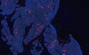Visualisierung der α- und ß-Zellen der Langerhans-Inseln