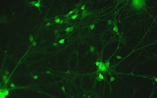 Aktivität von aus iPS-Zellen gewonnenen Nervenzellen