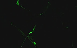 Axonale Elongation neuraler Progenitorzellen (PC12)
