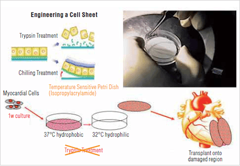 Bild: Entwicklung der myokardialen regenerativen Behandlung unter Verwendung einer myokardialen Zellschicht...