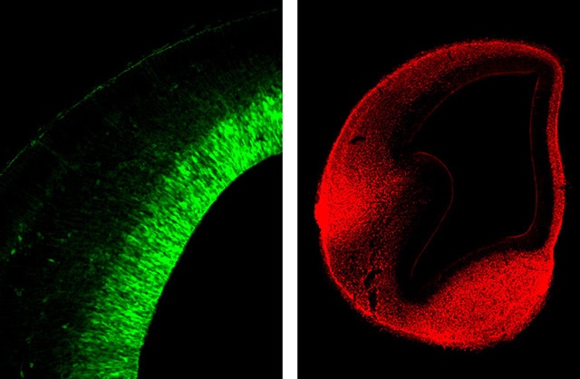 Bilder: Das Foto links zeigt eine neurale Stammzelle, die Grundlage des Nervensystems...
