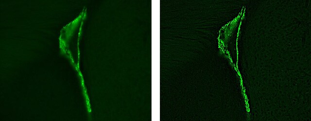 Bilder: Gefärbte vergrößerte Bilder von Ependymzellen einer erwachsenen Maus...