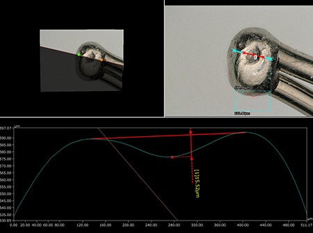 Profilmessung eines Lötfehlers auf einer Elektrode mit dem 4K-Digitalmikroskop der Modellreihe VHX